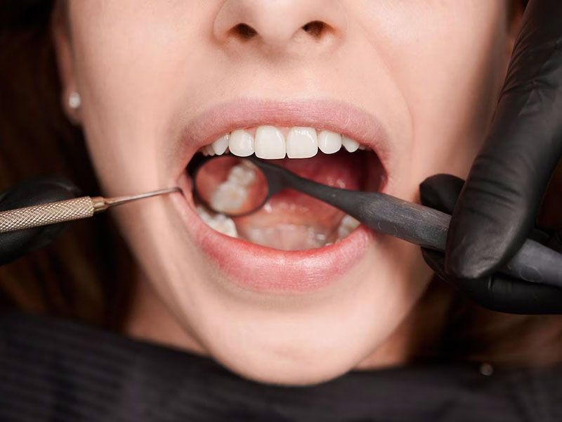 Протезирование нижних зубов цена