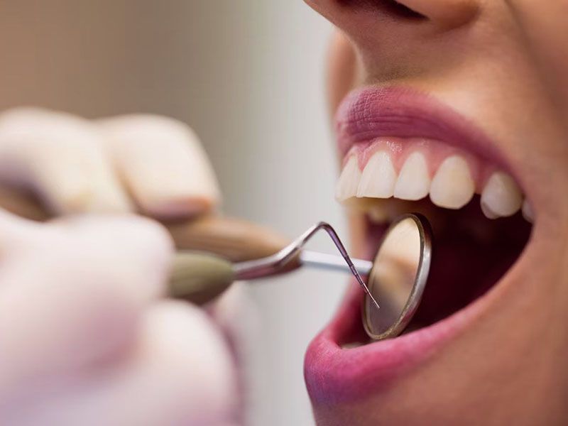 Стоимость имплантации зубов под ключ