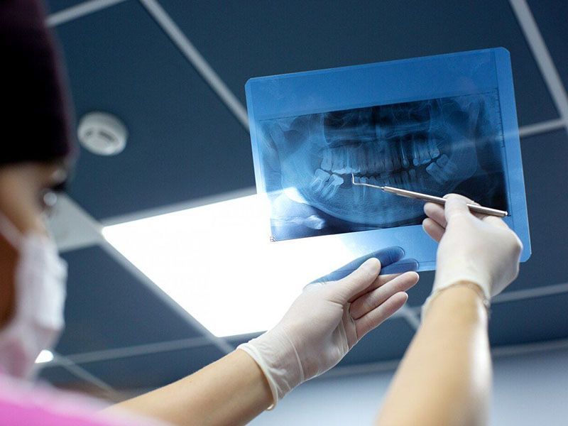 Установка зубного импланта цена