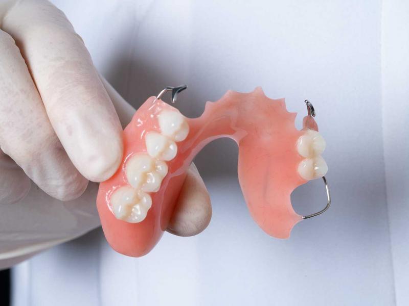 Акриловые зубные протезы съемные частичные