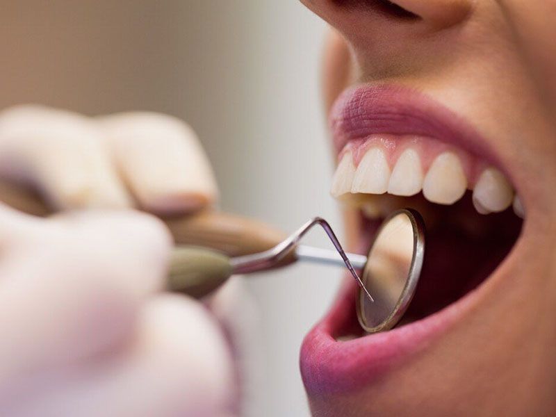 Современные методы реставрации зубов в клинике 14*14